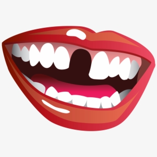 Dentist missing teeth funny. Dental clipart tooth smile