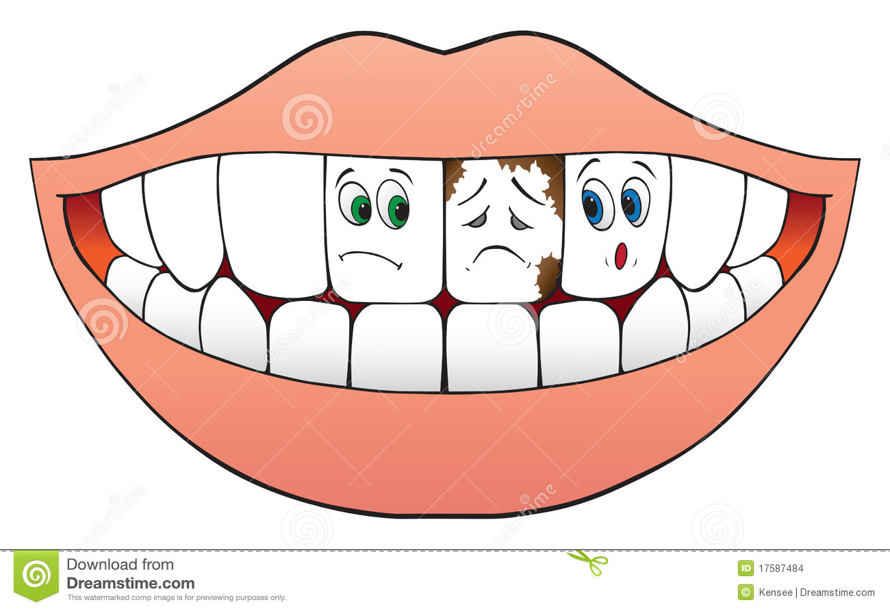 Dentist clipart unhealthy tooth.  teeth clipartlook