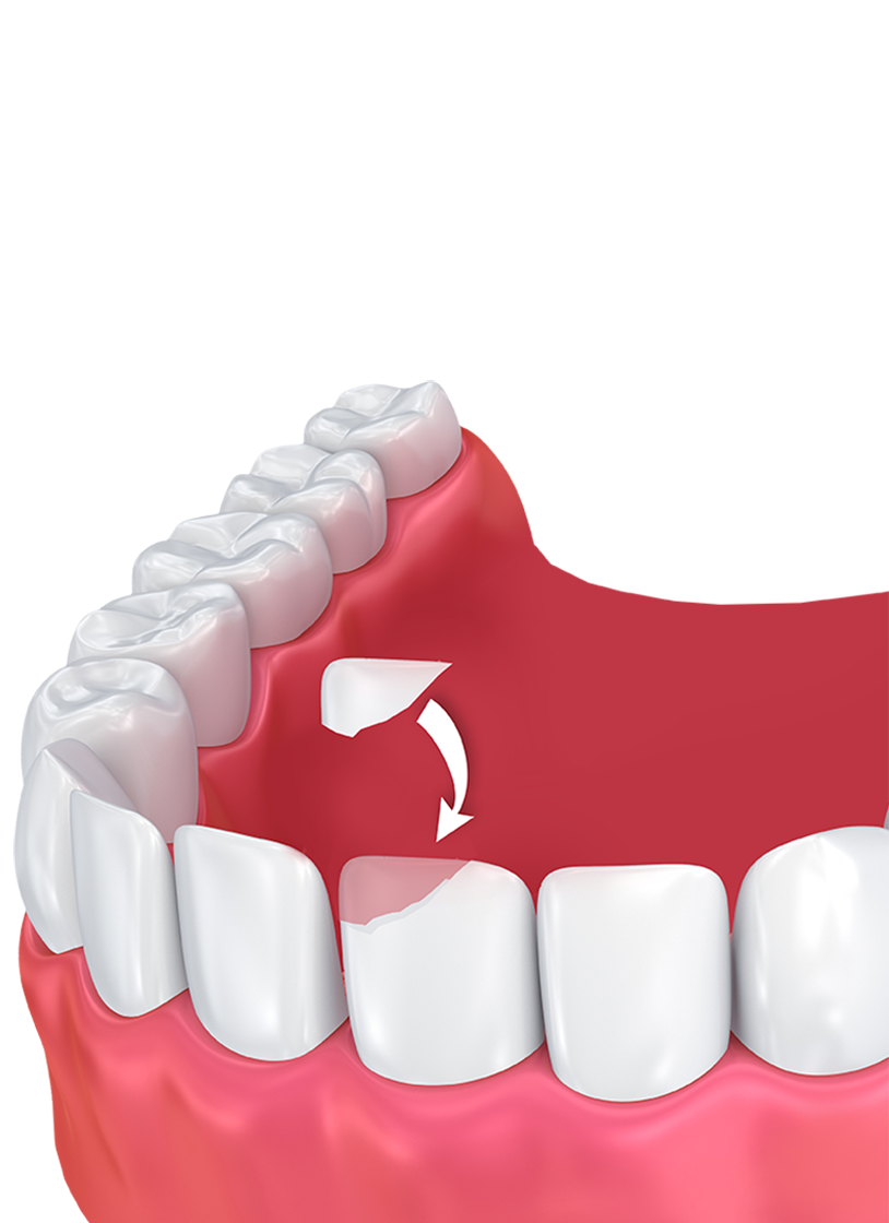 dental clipart wobbly tooth