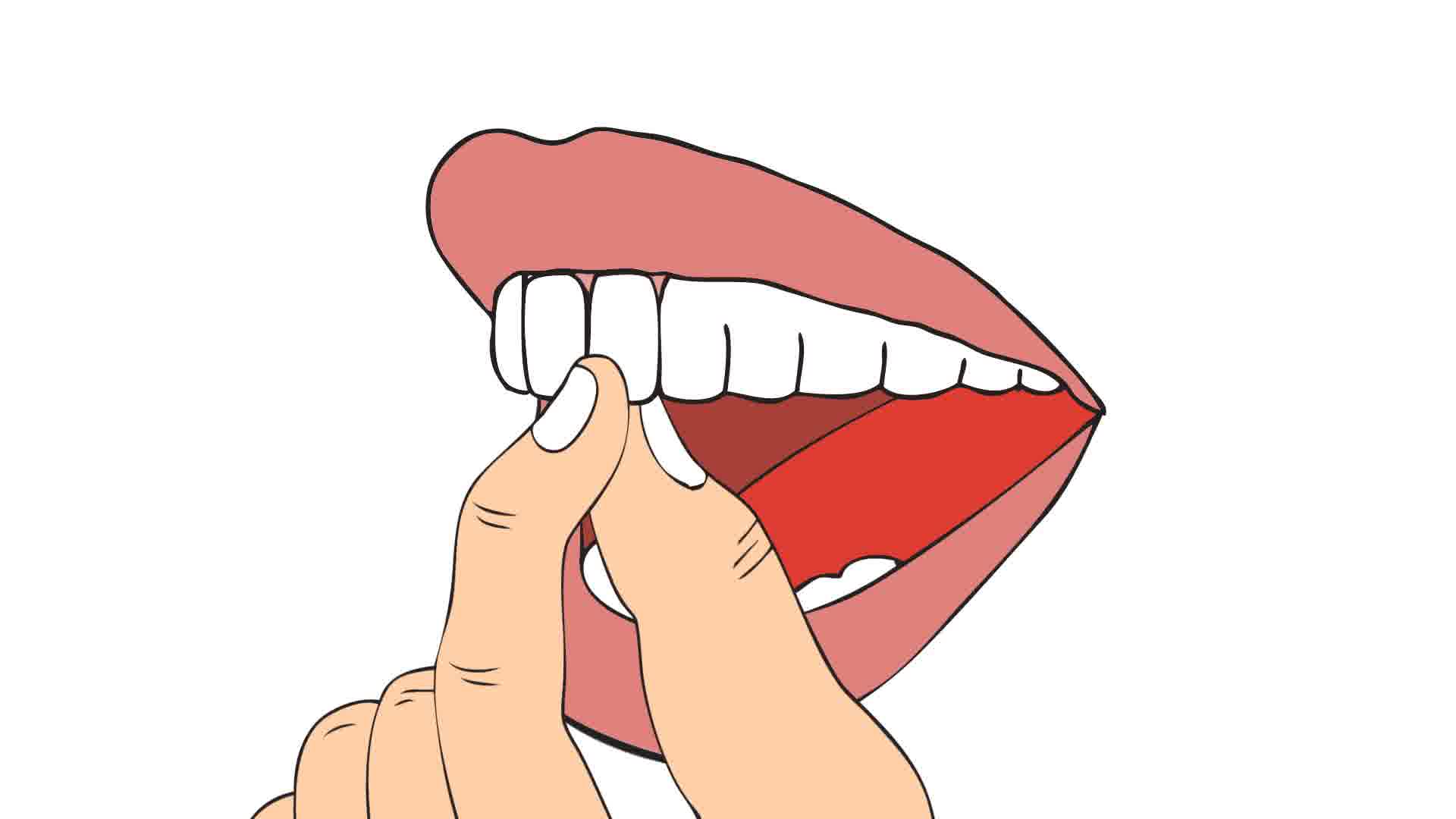 dental clipart wobbly tooth