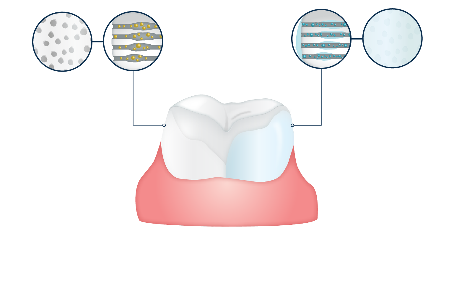 Scarborough dentists fluoride treatment. Dentist clipart dental history