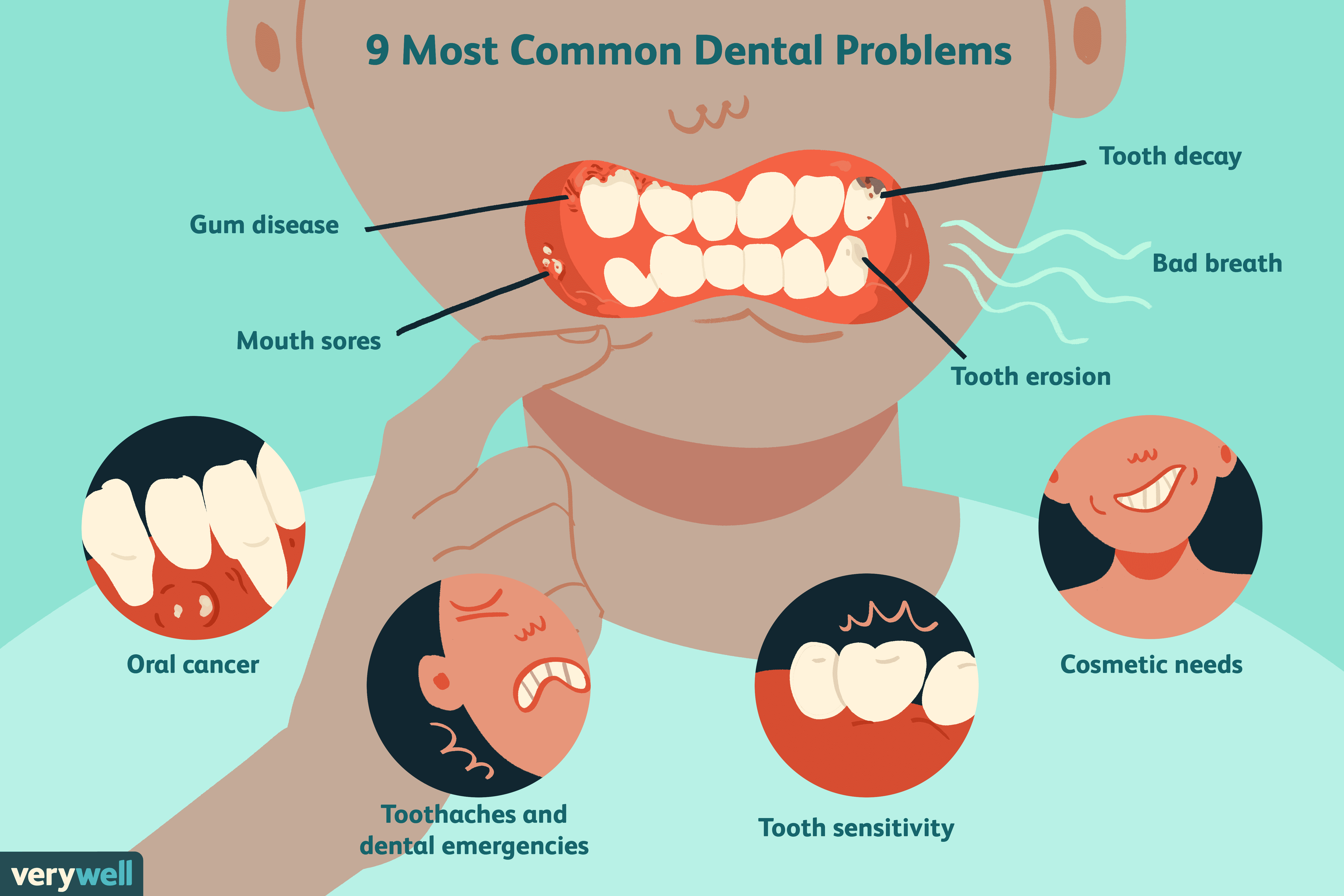 dentist clipart dental problem