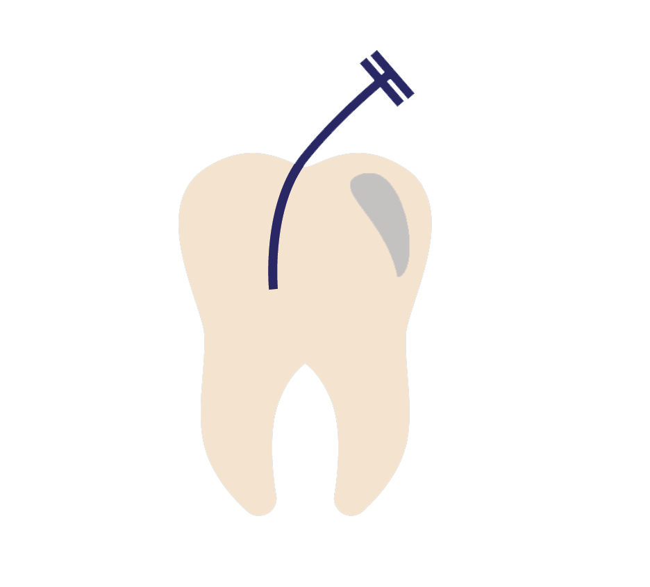 dentist clipart endodontist