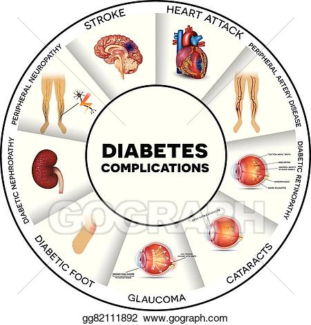 Diabetes clipart clip art. Vector illustration complications stock