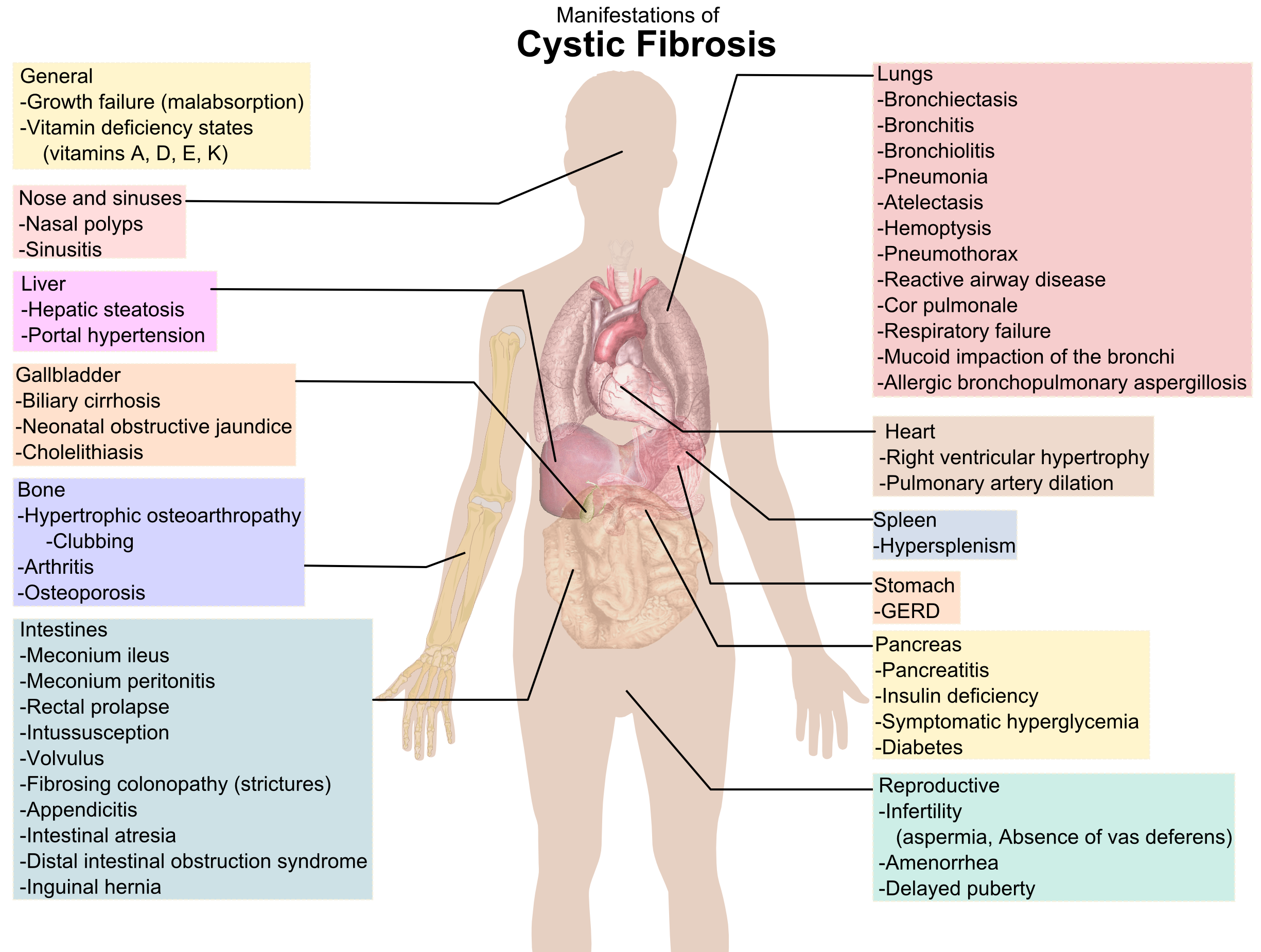 Organ systems of body. Diabetes clipart hyperglycemia