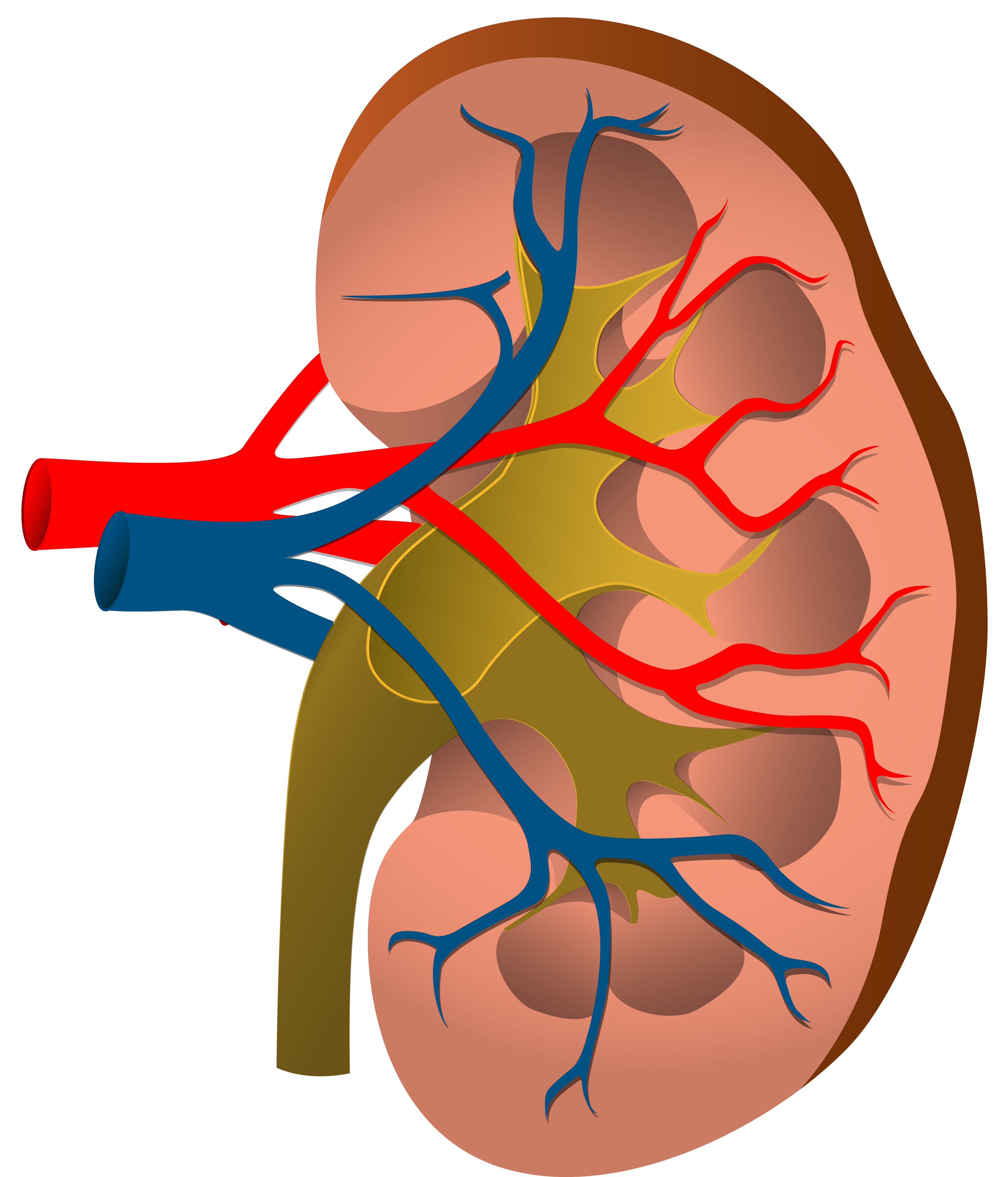 Disease Clipart Acute Disease Picture 915666 Disease Clipart Acute 