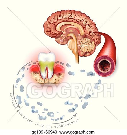 Disease clipart complication. Eps vector teeth problems