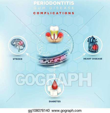 Disease clipart complication. Eps vector gum complications