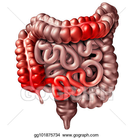 Drawings crohn s stock. Disease clipart crohn's disease