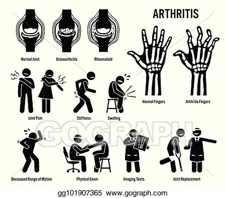 pain clipart arthritis