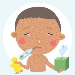 disease clipart direct contact