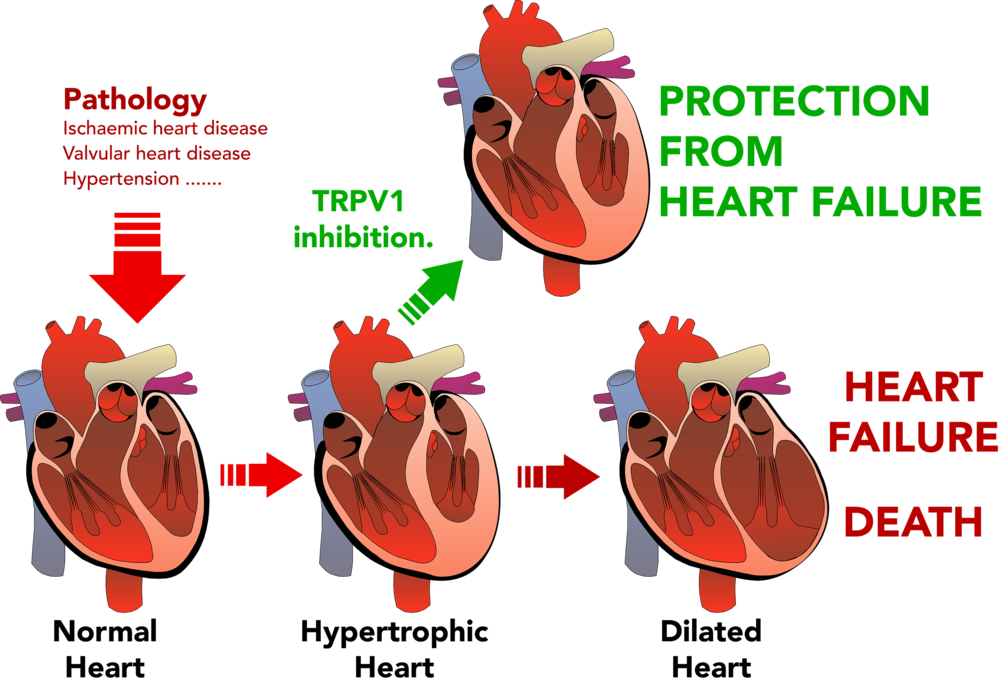pain clipart heart disease