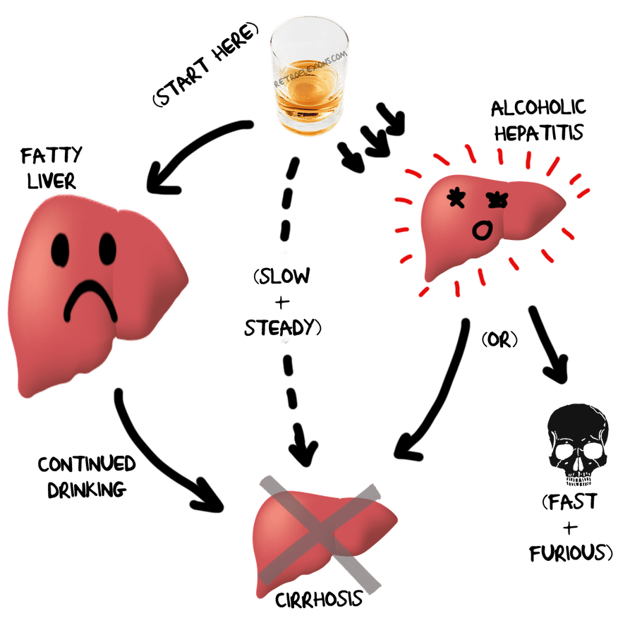 Liver clipart liver damage. How exactly does alcohol
