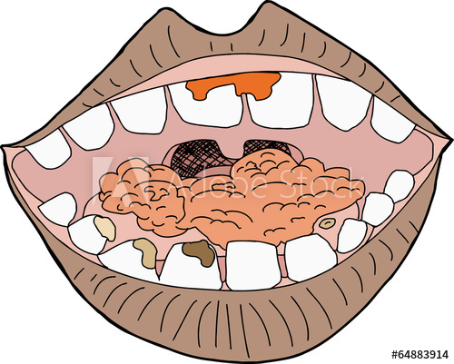 Eat clipart mouth full food, Eat mouth full food Transparent FREE for