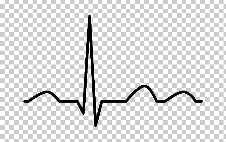 Electrocardiography interpretation heart rate. Ekg clipart ecg