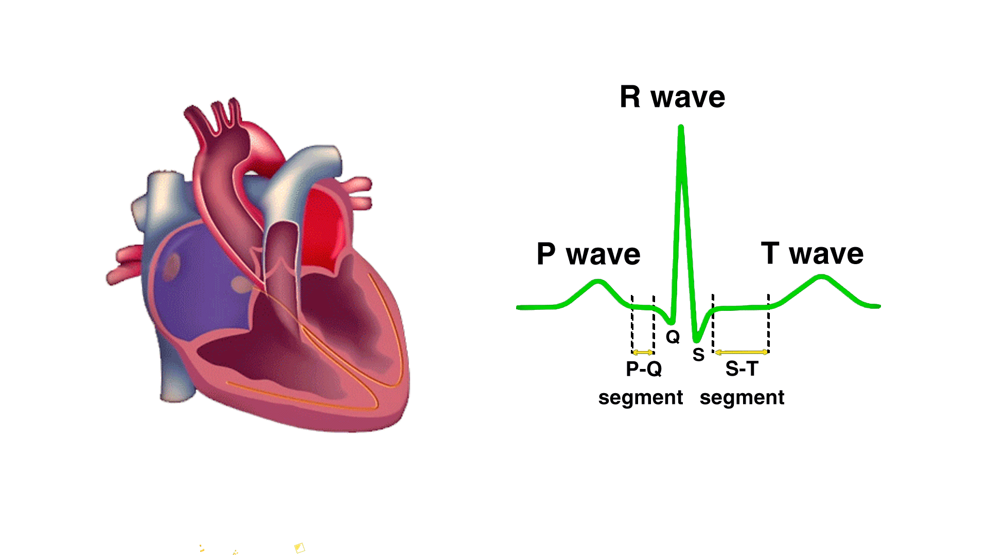 Ekg clipart heart pump. How does the work