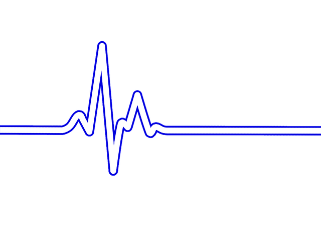 Ekg clipart heart rhythm. Free photo art electrocardiogram