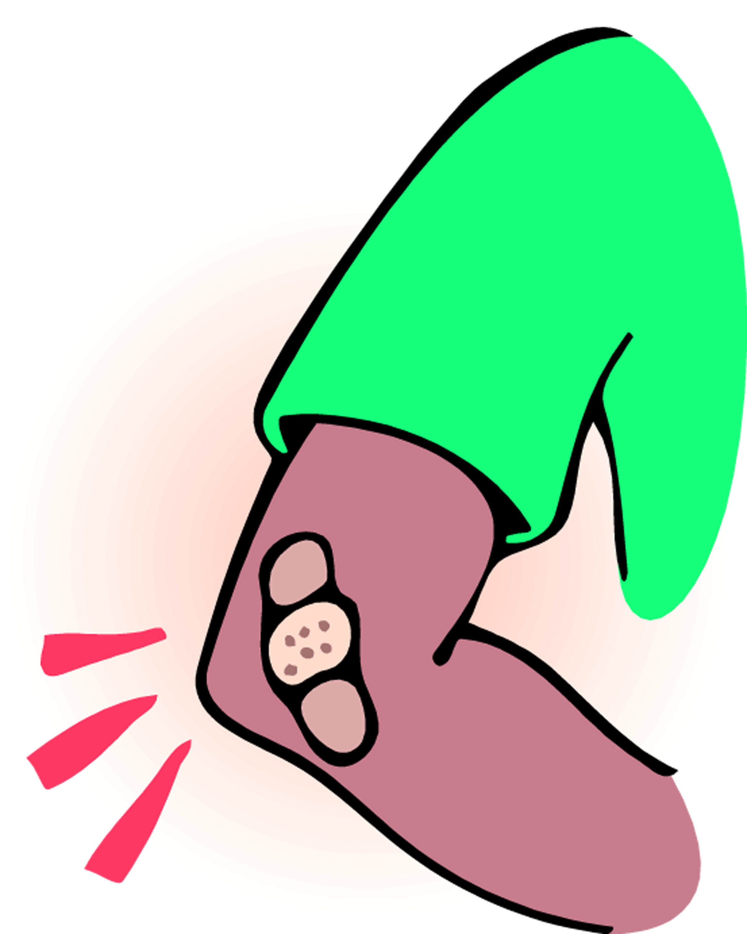 elbow clipart elbow pain