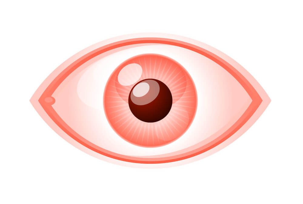 eyeball clipart eye infection
