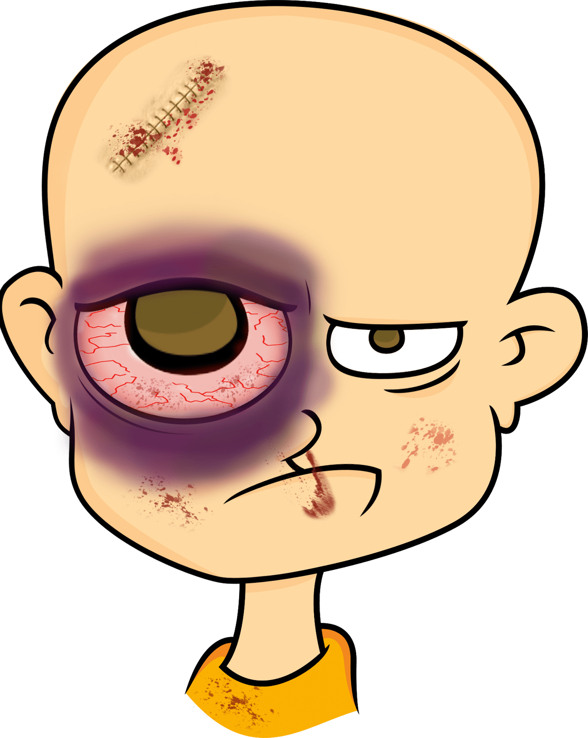 Eyebrow clipart eyelid. Procedure lateral canthotomy first