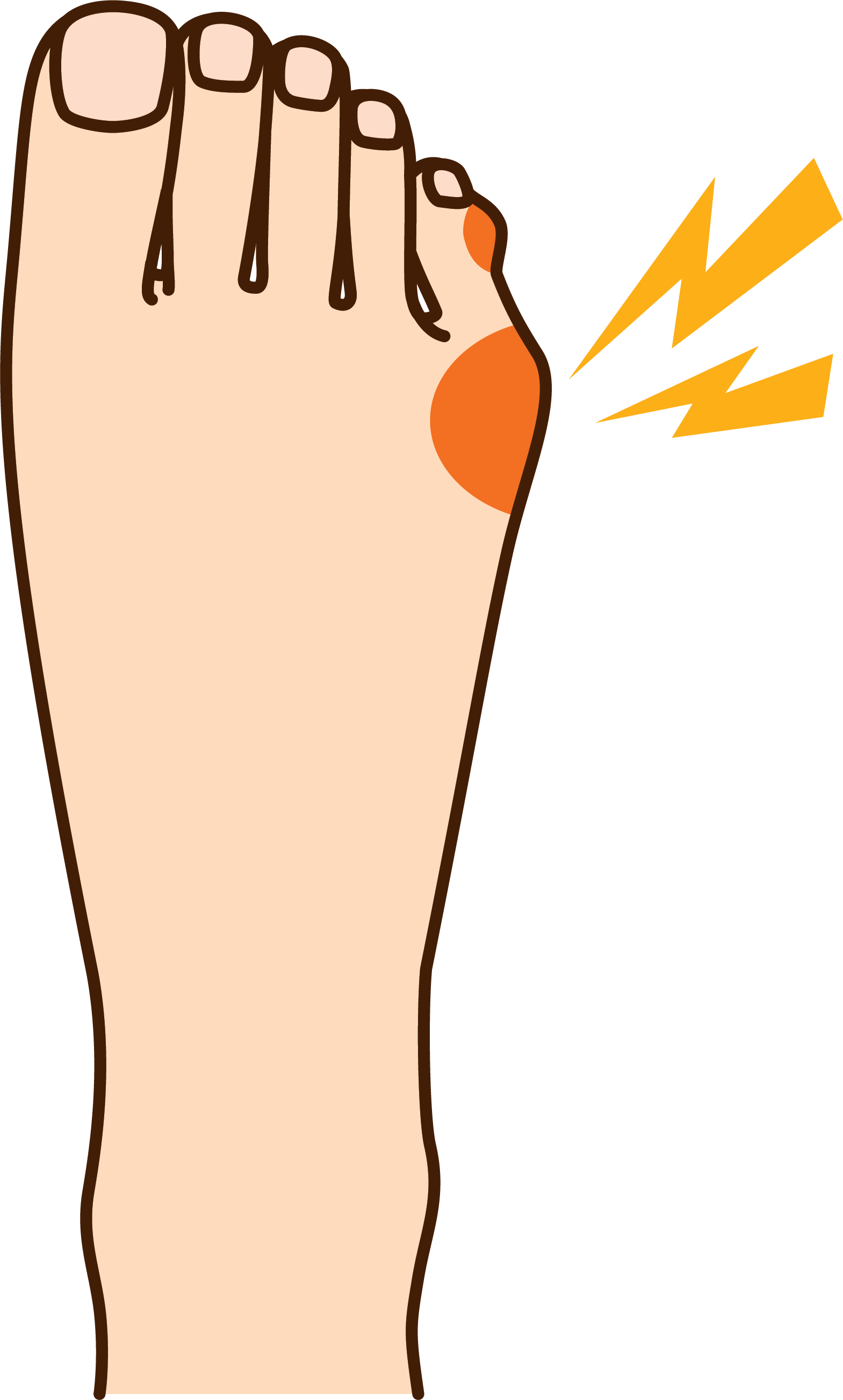 feet clipart diabetic foot