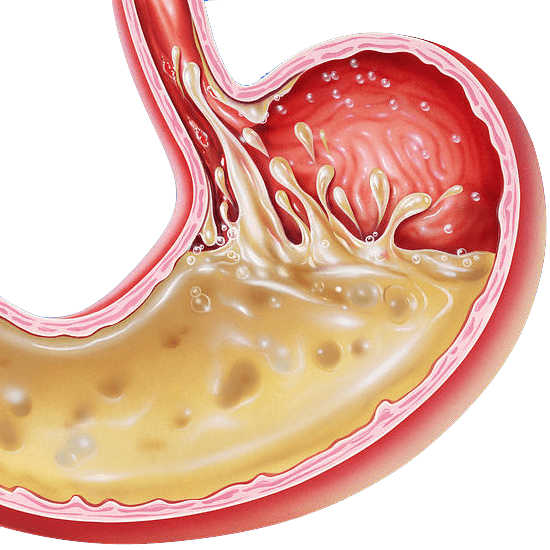 possible causes of. Fever clipart acidity