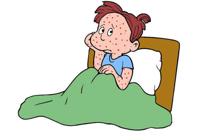 fever clipart acute disease