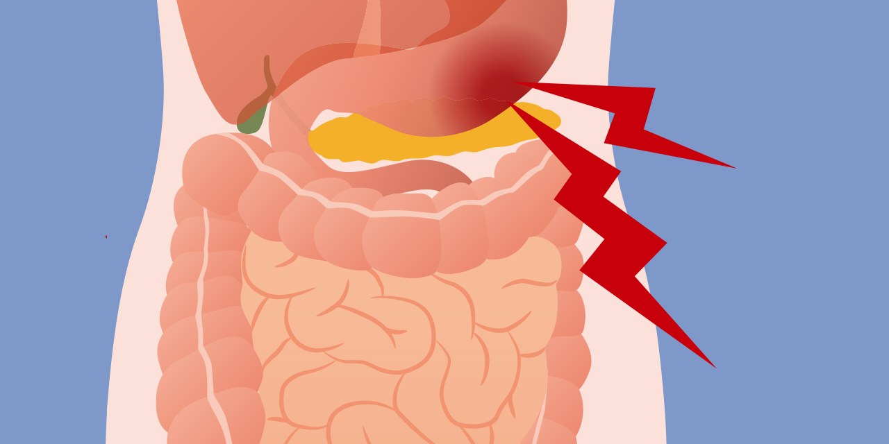 Abdominal pain how to. Fever clipart sore stomach