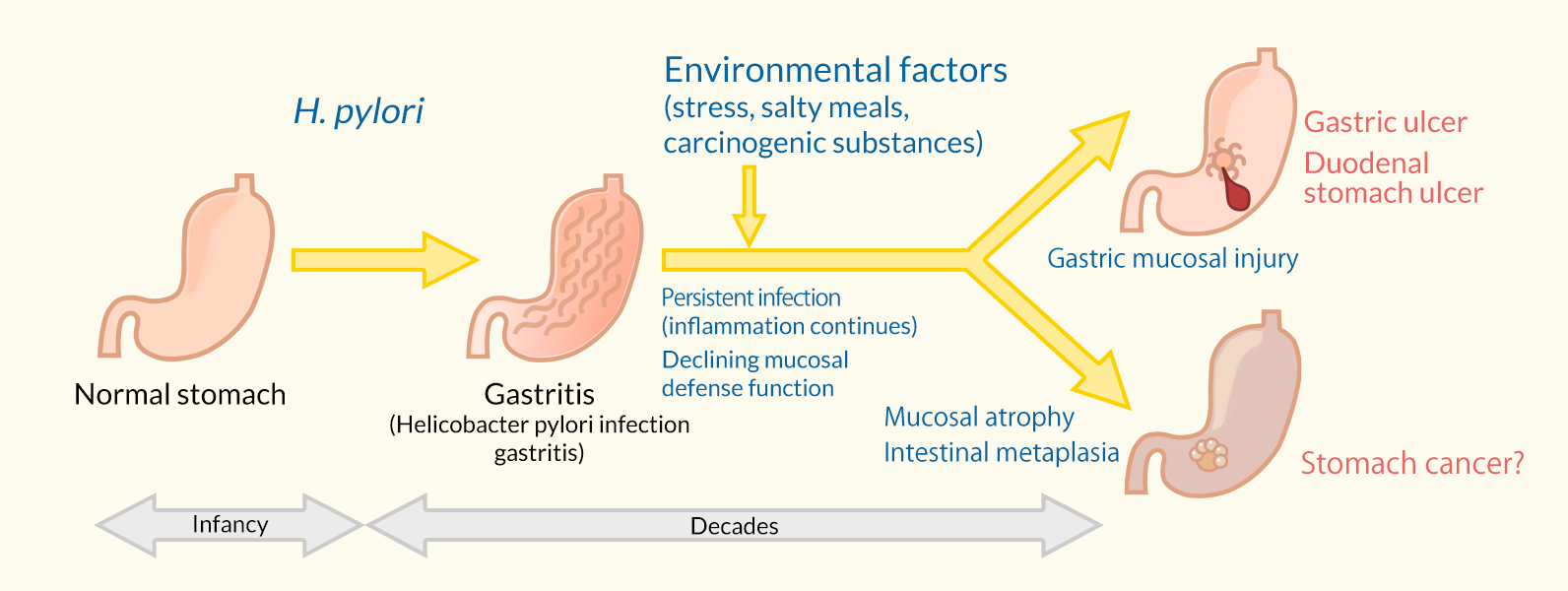 pain clipart gastritis