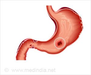 fever clipart stomach ulcer