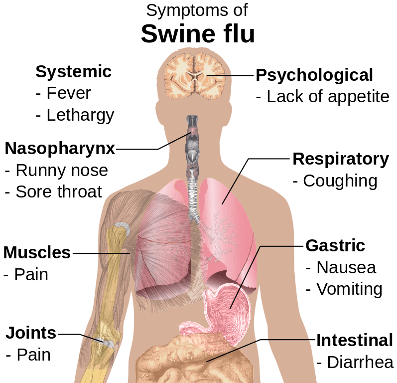 Flu clipart swine flu. Nepaliaustralian around that time
