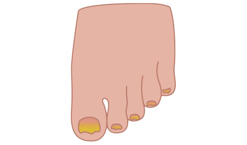 nail clipart toenail