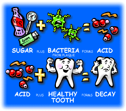 germs clipart dental caries