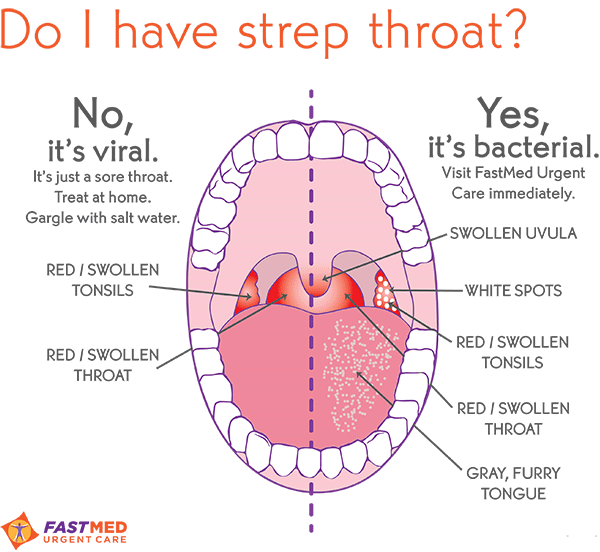Germ clipart streptococcus. Viral or strep do