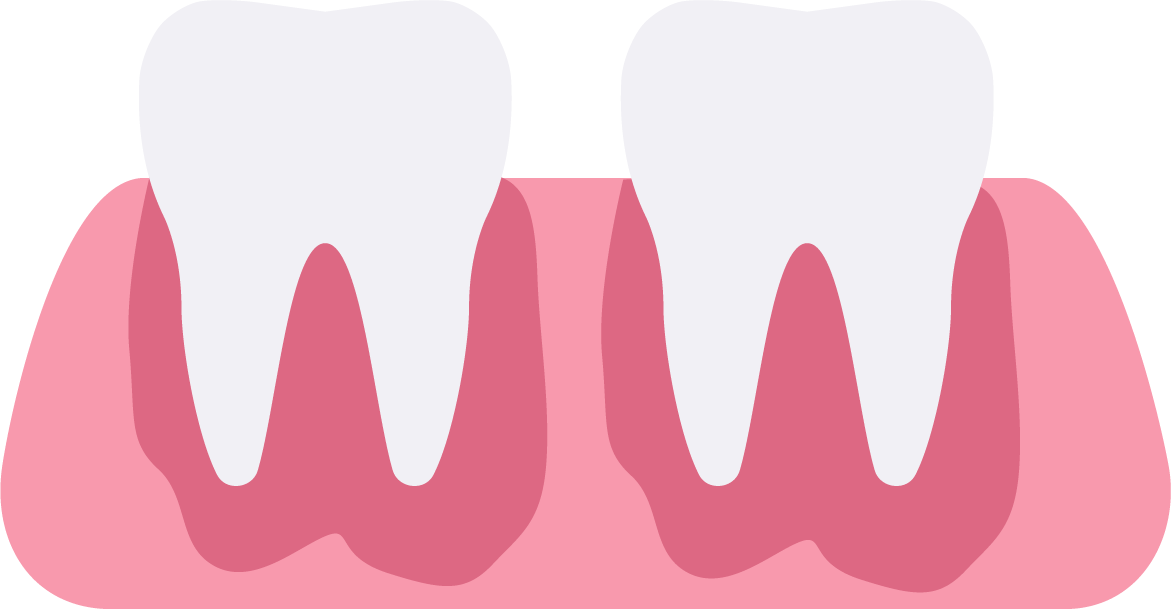 tooth clipart gum disease
