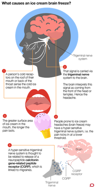 Health check does my. Headache clipart brain pain