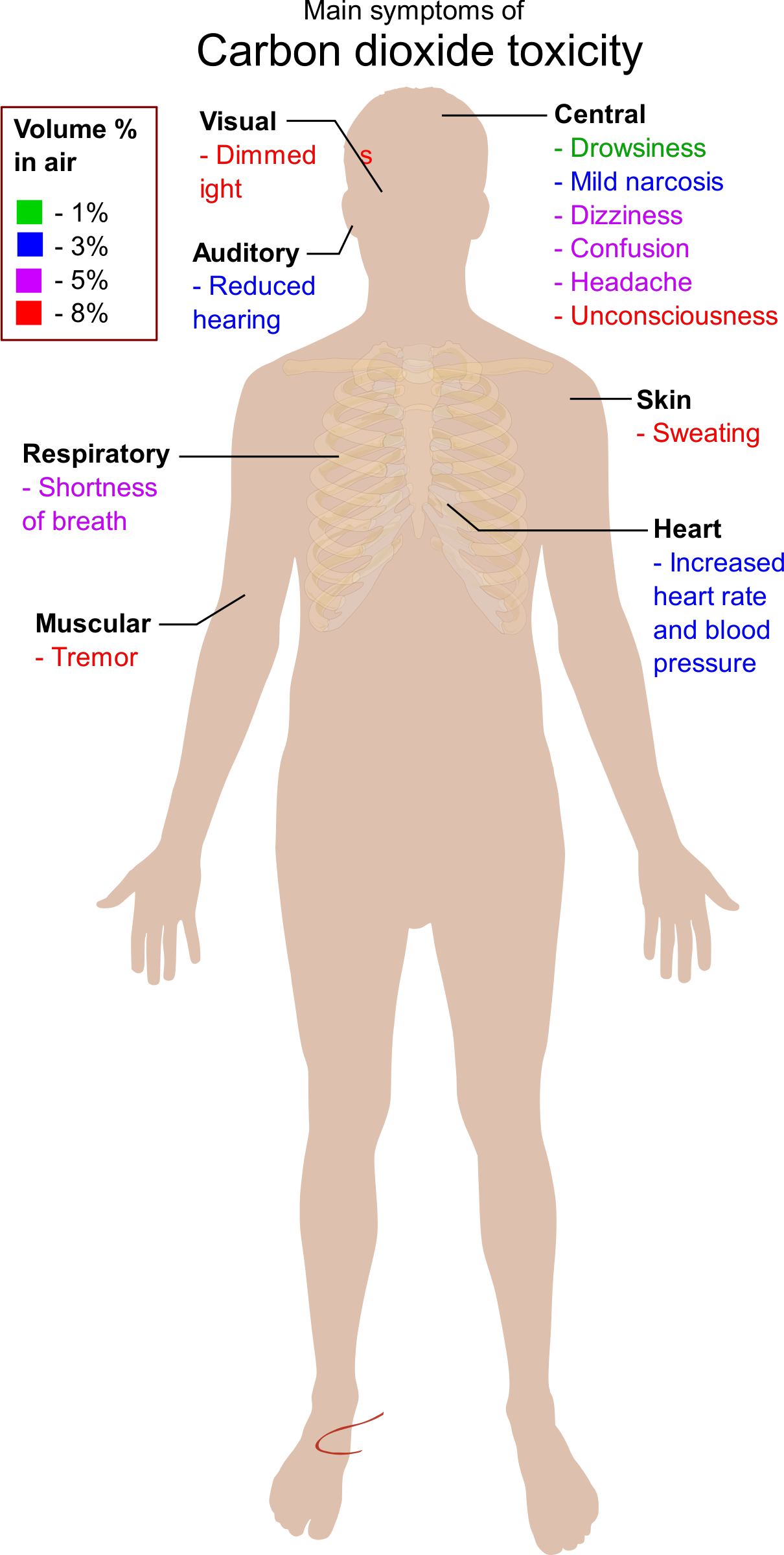 headache clipart symptom