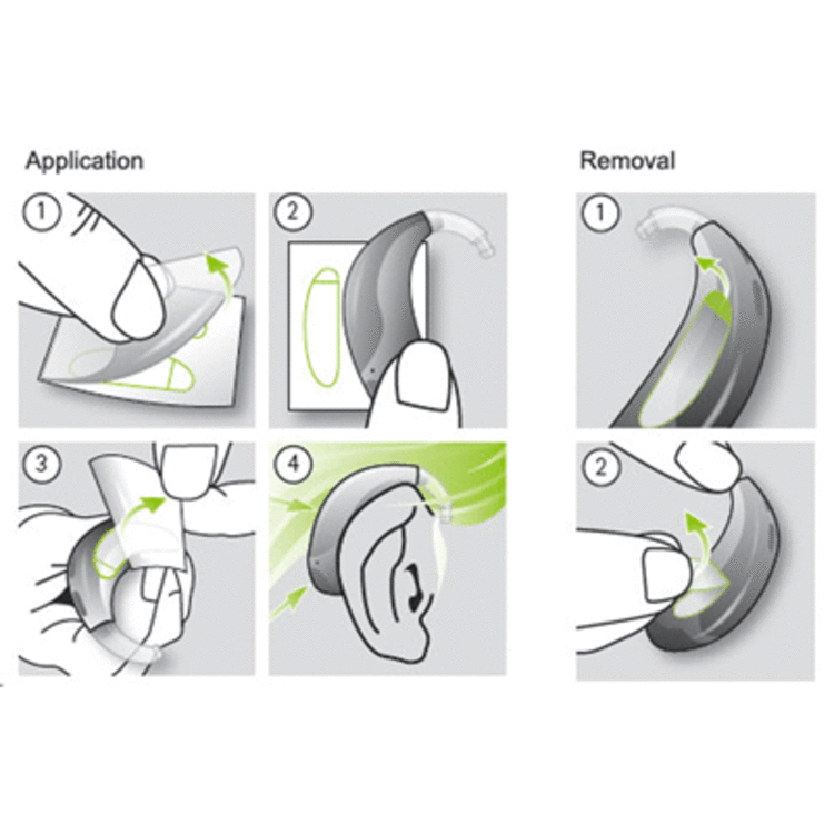Phonak stick n stay. Hearing clipart clear voice