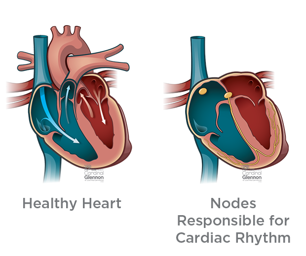 heartbeat clipart bradycardia