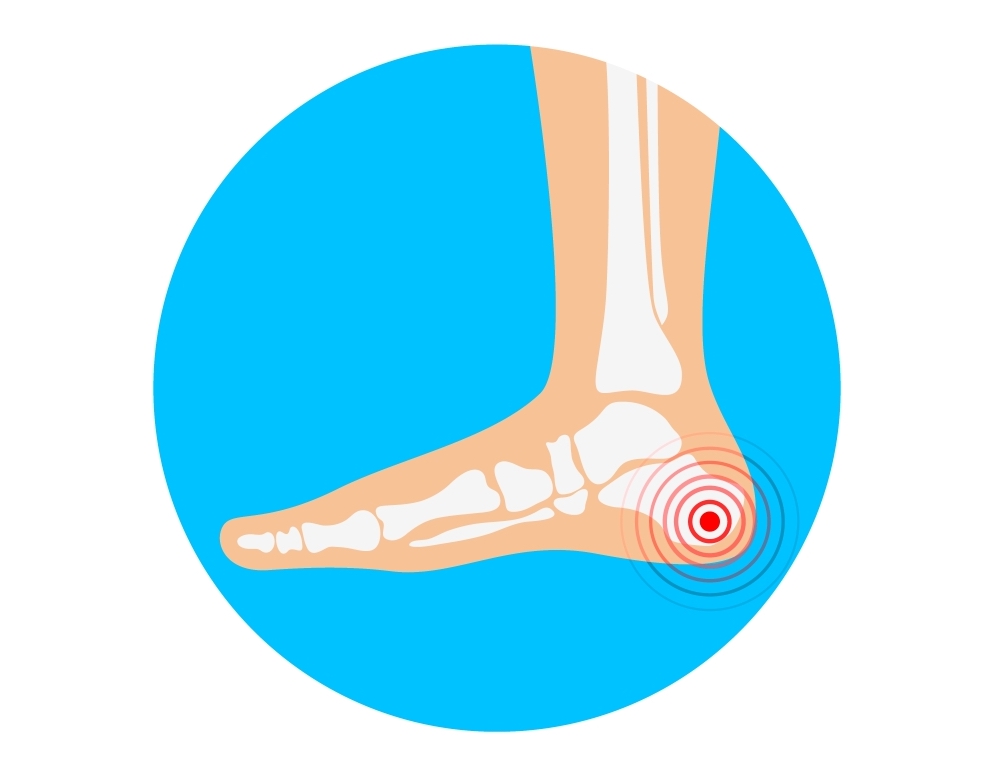 Heels clipart heel pain. Bone spur help what