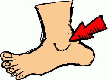 Injury clipart foot injury. Free ankle cliparts download
