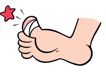 Hurt clipart stub toe. Cowspotdog the broken 