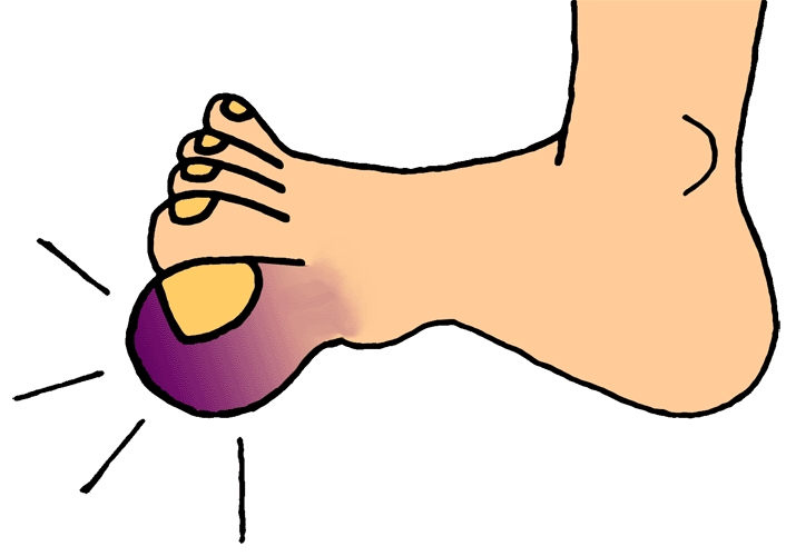 pain clipart big toe