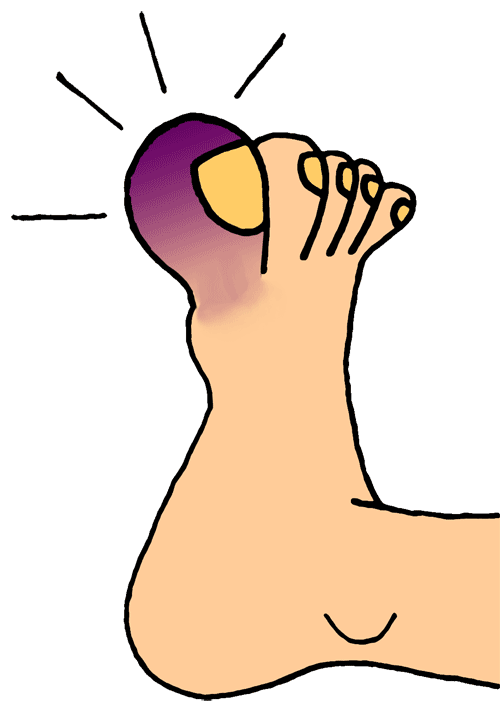 hurt clipart stubbed toe