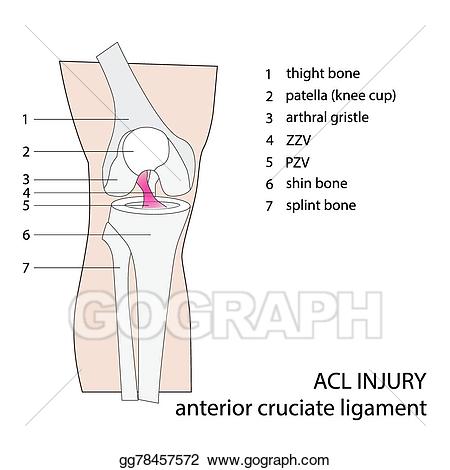 Injury clipart acl injury. Vector art knee eps