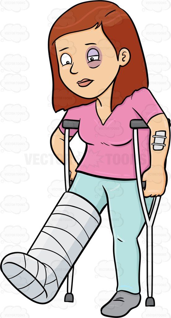 Pin on printables . Injury clipart bloated