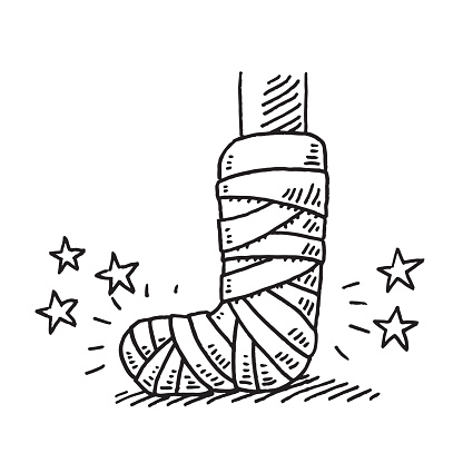 injury clipart leg cast