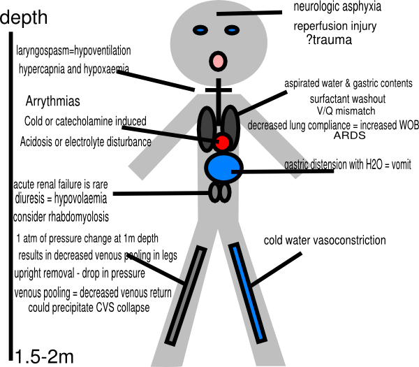Stick figure pathophysiology of. Injury clipart stickman