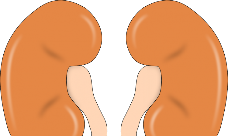 kidney clipart acute kidney injury