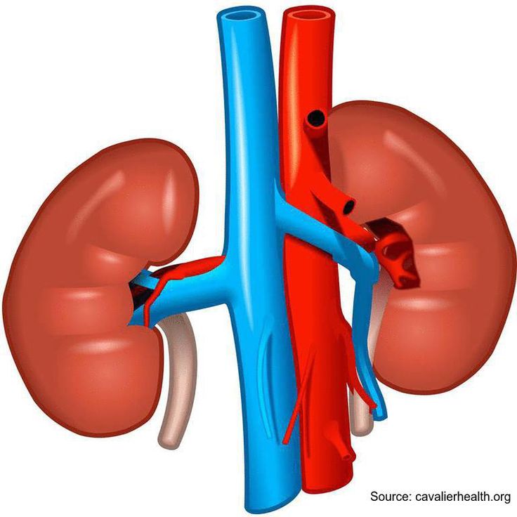 Chronic disease health repercussionswatif. Kidney clipart kidney dialysis